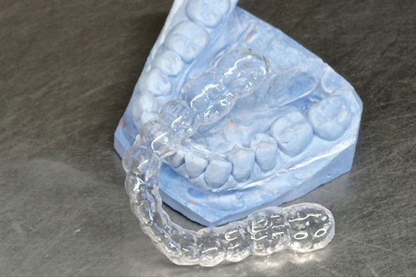 Bite realizzato da Saba Dental Lab