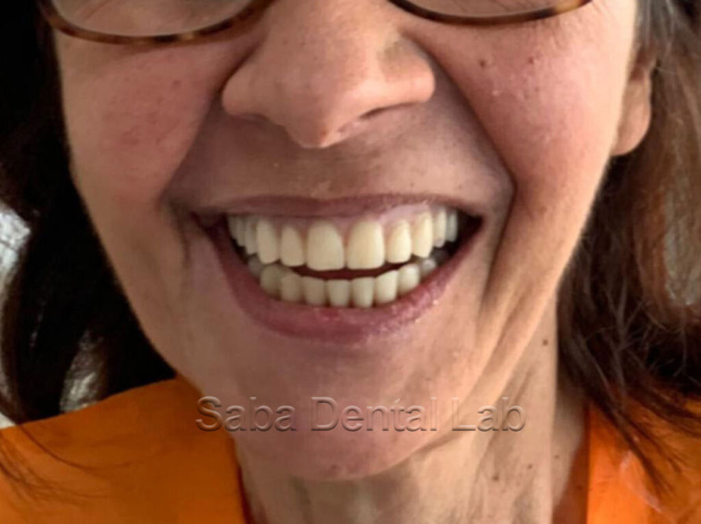 Risultato finale Clara